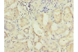 Immunohistochemistry of paraffin-embedded human kidney tissue using ABIN7175029 at dilution of 1:100 (C5ORF22 anticorps  (AA 101-420))