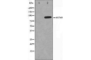Western blot analysis on HepG2 cell lysate using MCM5 Antibody. (MCM5 anticorps  (N-Term))
