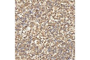 IHC analysis of Citrin/SLC25A13 using anti-Citrin/SLC25A13 antibody (ABIN7599512). (slc25a13 anticorps  (AA 1-643))