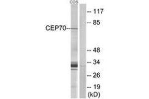 Western blot analysis of extracts from COS cells, using CEP70 Antibody. (CEP70 anticorps  (AA 241-290))