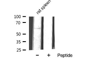 Western blot analysis of TGFBR2 expression in rat spleen tissue. (TGFBR2 anticorps  (Internal Region))
