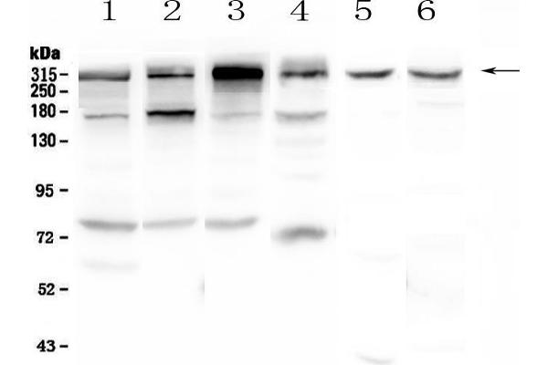 IGF2R anticorps  (AA 424-529)