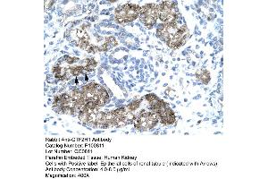 Human kidney (GTF2H1 anticorps  (N-Term))