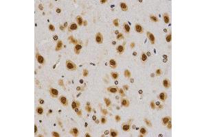 Immunohistochemistry of paraffin-embedded rat brain using Asymmetric DiMethyl-Histone H4-R3 antibody (ABIN1872990) at dilution of 1:200 (40x lens).