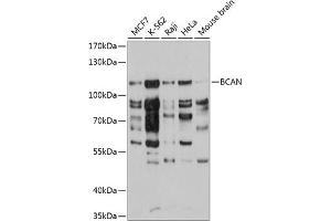 Western blot analysis of extracts of various cell lines, using BCAN antibody  at 1:3000 dilution.
