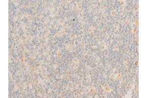 ABIN6267219 at 1/100 staining human appendiceal tissue sections by IHC-P.