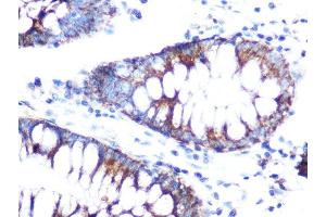 Immunohistochemistry of paraffin-embedded human colon using Folate Binding Protein(FBP) / FOLR1 Rabbit pAb (ABIN7267224) at dilution of 1:100 (40x lens).