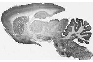 Adult rat brain immunohistochemistry. (TMEM91 anticorps  (Cytosolic, N-Term))