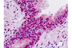 Anti-MAT / MAT1A antibody IHC staining of human lung. (MAT1A anticorps  (AA 107-136))