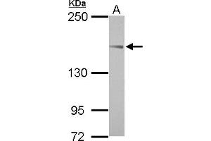 Image no. 1 for anti-ABI Family, Member 3 (NESH) Binding Protein (ABI3BP) (AA 704-903) antibody (ABIN1496391) (ABI3BP anticorps  (AA 704-903))
