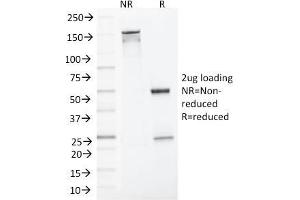 SDS-PAGE Analysis Purified MLH1 Mouse Monoclonal Antibody (MLH1/1324). (MLH1 anticorps)