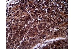 Image no. 1 for anti-Histone Deacetylase 1 (HDAC1) antibody (ABIN216078) (HDAC1 anticorps)
