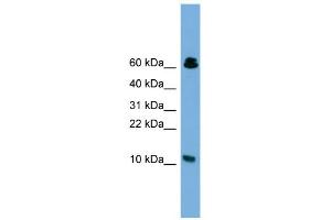 WB Suggested Anti-SUPT4H1 Antibody Titration: 0.