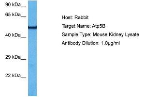 Host:  Mouse  Target Name:  ATP5B  Sample Tissue:  Mouse Kidney  Antibody Dilution:  1ug/ml (ATP5B anticorps  (N-Term))