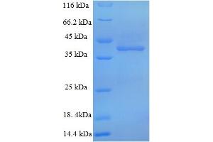 SDS-PAGE (SDS) image for Hyaluronan Synthase 2 (HAS2) (AA 67-374), (Cytoplasmic Domain), (Cytosolic) protein (His tag) (ABIN5709643)
