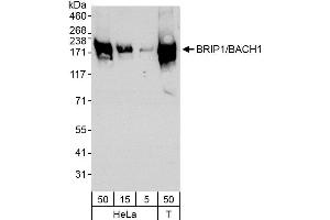 Western Blotting (WB) image for anti-BRCA1 Interacting Protein C-terminal Helicase 1 (BRIP1) (C-Term) antibody (ABIN7449567)