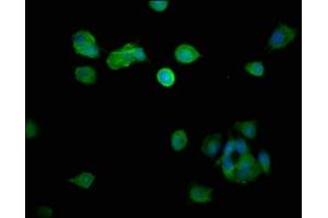 Immunofluorescence staining of MCF-7 cells with ABIN7150805 at 1:266, counter-stained with DAPI. (Dynamitin anticorps  (AA 1-252))