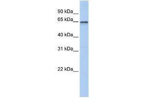 WB Suggested Anti-AHCYL1 Antibody Titration: 0. (AHCYL1 anticorps  (N-Term))