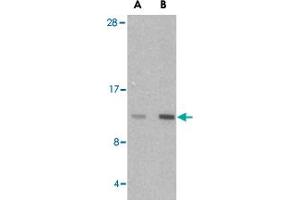 Western blot analysis of HRK in mouse pancreas tissue lysate with HRK polyclonal antibody  at (A) 2. (HRK anticorps  (Internal Region))