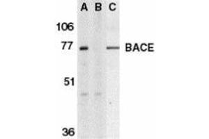 Western blot analysis of BACE in human brain tissue lysate in the absence (A) or presence (B) of blocking peptide and in mouse 3T3 cell lysate (C) with AP30111PU-N BACE antibody at 1 μg/ml. (BACE1 anticorps  (C-Term))