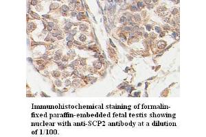 Image no. 1 for anti-Sterol Carrier Protein 2 (SCP2) antibody (ABIN791185) (SCP2 anticorps)