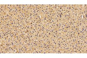 anti-Adiponectin (ADIPOQ) (AA 108-244) antibody