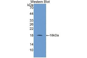Detection of Recombinant UBE2I, Human using Polyclonal Antibody to Ubiquitin Conjugating Enzyme E2I (UBE2I)