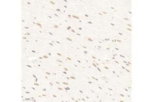 Immunohistochemistry of paraffin embedded rat heart using SUPT3H (ABIN7075767) at dilution of 1: 1500 (400x lens) (SUPT3H/SPT3 anticorps)