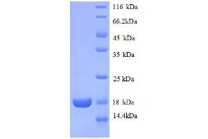 Ribosomal Protein L31 (RPL31) (AA 1-125), (full length) protein (His tag) (RPL31 Protein (AA 1-125, full length) (His tag))