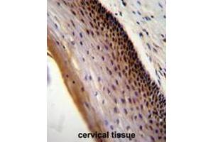 CCDC102A Antibody (C-term) immunohistochemistry analysis in formalin fixed and paraffin embedded human cervical tissue followed by peroxidase conjugation of the secondary antibody and DAB staining.