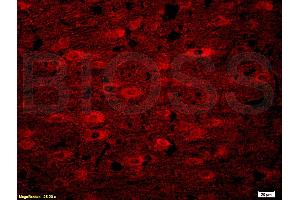 Formalin-fixed and paraffin embedded rat brain tissue labeled with Anti-Alpha-Synuclein/Syn/SNCA Polyclonal Antibody, Unconjugated (ABIN730393) at 1:200, followed by conjugation to the secondary antibody Goat Anti-Rabbit IgG, Cy3 conjugated used at 1:200 dilution for 40 minutes at 37°C. (SNCA anticorps  (AA 1-140))