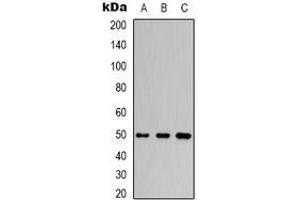 Western blot analysis of Beta3-tubulin expression in Hela (A), mouse brain (B), rat brain (C) whole cell lysates. (TUBB3 anticorps)