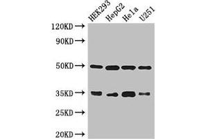 Western Blot Positive WB detected in: HEK293 whole cell lysate, HepG2 whole cell lysate, Hela whole cell lysate, U251 whole cell lysate All lanes: LZTFL1 antibody at 3 μg/mL Secondary Goat polyclonal to rabbit IgG at 1/50000 dilution Predicted band size: 35, 33, 30 kDa Observed band size: 35, 50 kDa