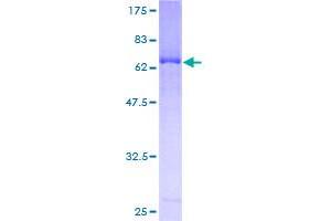 Image no. 1 for Mitogen-Activated Protein Kinase Kinase 3 (MAP2K3) protein (GST tag) (ABIN1310175)