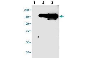 Western blot analysis of CFP monoclonal antibody, clone 98s55  in 10 ug lysate from GFP fusion protein prositive 293 cells. (CFP anticorps  (N-Term))