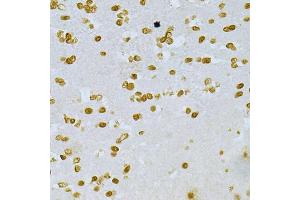 Immunohistochemistry of paraffin-embedded mouse brain using DKC1 Antibody (ABIN5970956) at dilution of 1/200 (40x lens). (DKC1 anticorps)