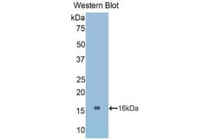 Western blot analysis of the recombinant protein. (CTGF anticorps  (AA 80-200))