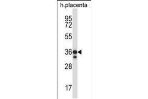 Western blot analysis in human placenta tissue lysates (35ug/lane). (STK26/MST4 anticorps  (AA 271-299))