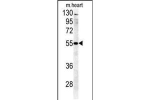 Western blot analysis in mouse heart tissue lysates (35ug/lane). (B4GALT5 anticorps  (C-Term))