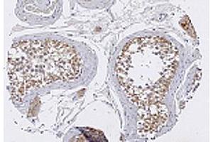 Immunohistochemical staining with TRIM29 polyclonal antibody  in normal testis tissue at 1 : 100 dilution. (TRIM29 anticorps  (AA 569-583))