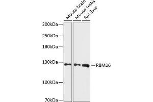 Western blot analysis of extracts of various cell lines, using RBM26 antibody (ABIN6130214, ABIN6146770, ABIN6146772 and ABIN6216994) at 1:3000 dilution. (RBM26 anticorps  (AA 65-140))