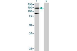 Western Blot analysis of HIP1R expression in transfected 293T cell line by HIP1R MaxPab polyclonal antibody. (HIP1R anticorps  (AA 1-1068))