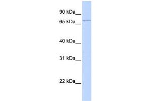 WB Suggested Anti-RNF6 Antibody Titration:  0. (RNF6 anticorps  (C-Term))