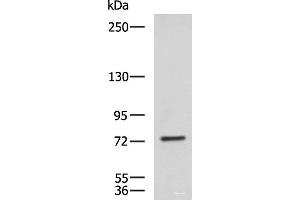 Western blot analysis of NIH/3T3 cell lysate using KIF2A Polyclonal Antibody at dilution of 1:850
