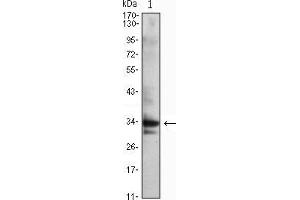 Western blot analysis using CDC2 mouse mAb against Jurkat (1) cell lysate. (CDK1 anticorps)