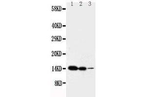Anti-IL2 antibody, Western blotting Lane 1: Recombinant Mouse IL2 Protein 10ng Lane 2: Recombinant Mouse IL2 Protein 5ng Lane 3: Recombinant Mouse IL2 Protein 2. (IL-2 anticorps  (C-Term))