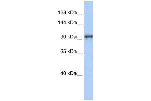 WB Suggested Anti-CCDC52 Antibody Titration: 0. (SPICE1 anticorps  (N-Term))