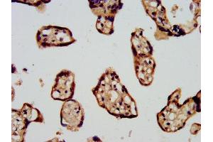IHC image of ABIN7169072 diluted at 1:500 and staining in paraffin-embedded human placenta tissue performed on a Leica BondTM system. (CDC42BPB anticorps  (AA 1609-1711))