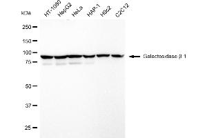 Western blotting analysis using Galactosidase beta 1 antibody (ABIN7798684). (Recombinant GLB1 anticorps)