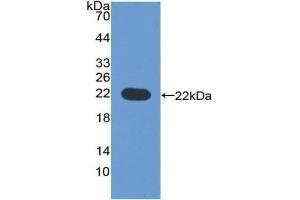 Detection of Recombinant CYP3A4, Human using Polyclonal Antibody to Cytochrome P450 3A4 (CYP3A4)